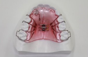 小児歯列拡大床装置2